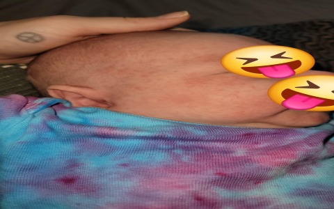 Baby red spots (Easy fixes)